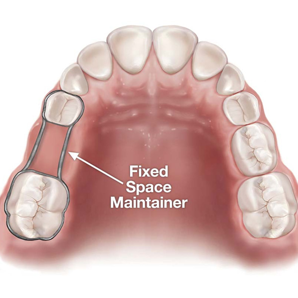 fixed space mainteiner