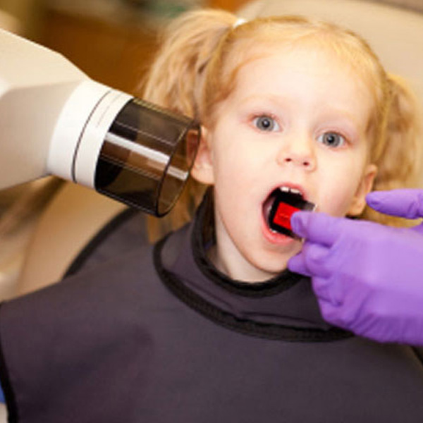 kids dental x-ray